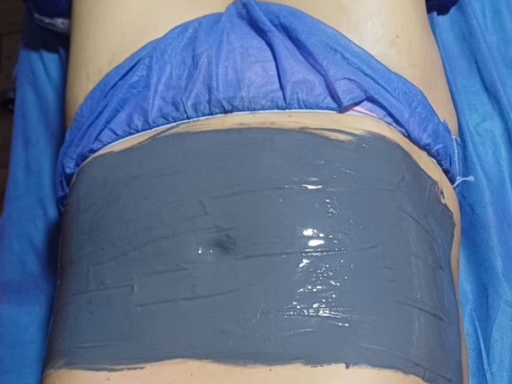 Tratamiento corporal con lodoterapia